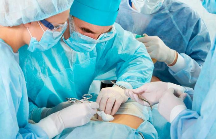 IESS emprende en campaña quirúrgica de hernias y vesículas