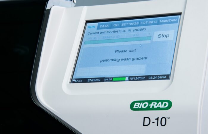 MEDILAB Cuenta Con Nuevo Equipo Para El Diagnóstico De Hemoglobina Glicosilada